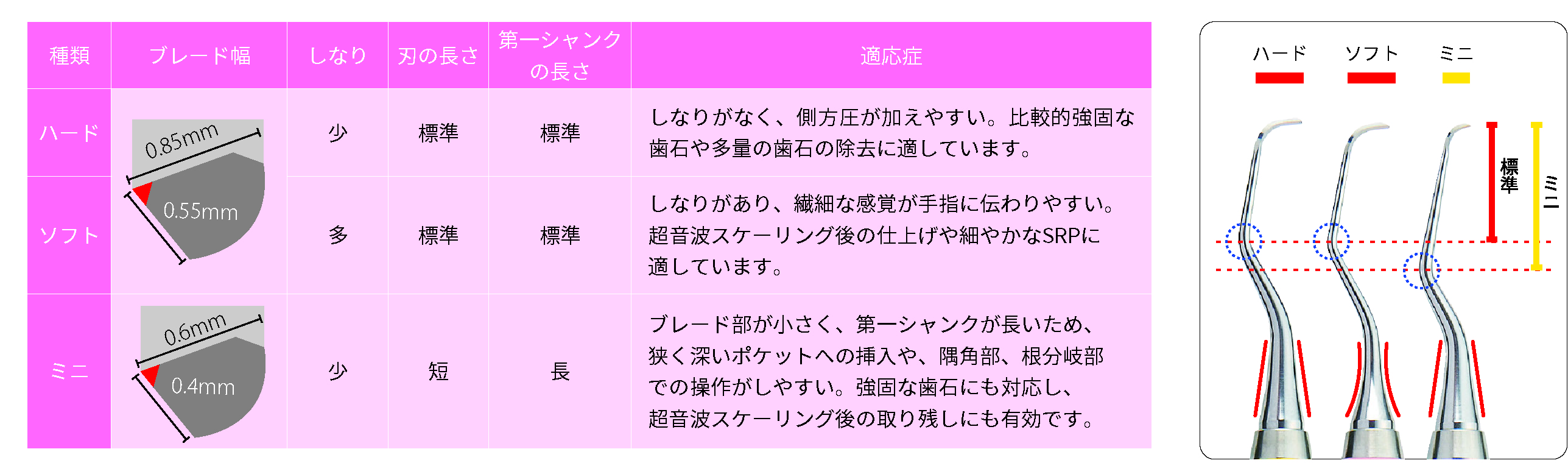 シャンク と は