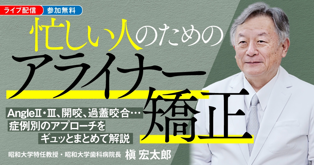 アライナー矯正のリカバリーテクニック 槇宏太郎 Amazon.co.jp: アライナー矯正のリカバリーテクニック : 槇 宏太郎, 槇