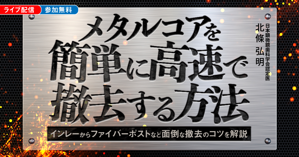 メタルコアを簡単に高速で撤去する方法｜歯科オンラインセミナー・録画