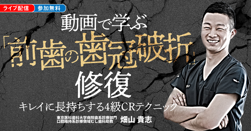 動画で学ぶ「前歯の歯冠破折」修復｜歯科オンラインセミナー・録画配信