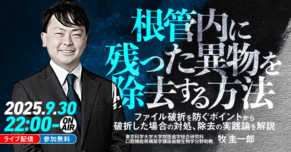 根管内に残った異物を除去する方法｜歯科オンラインセミナー・録画配信