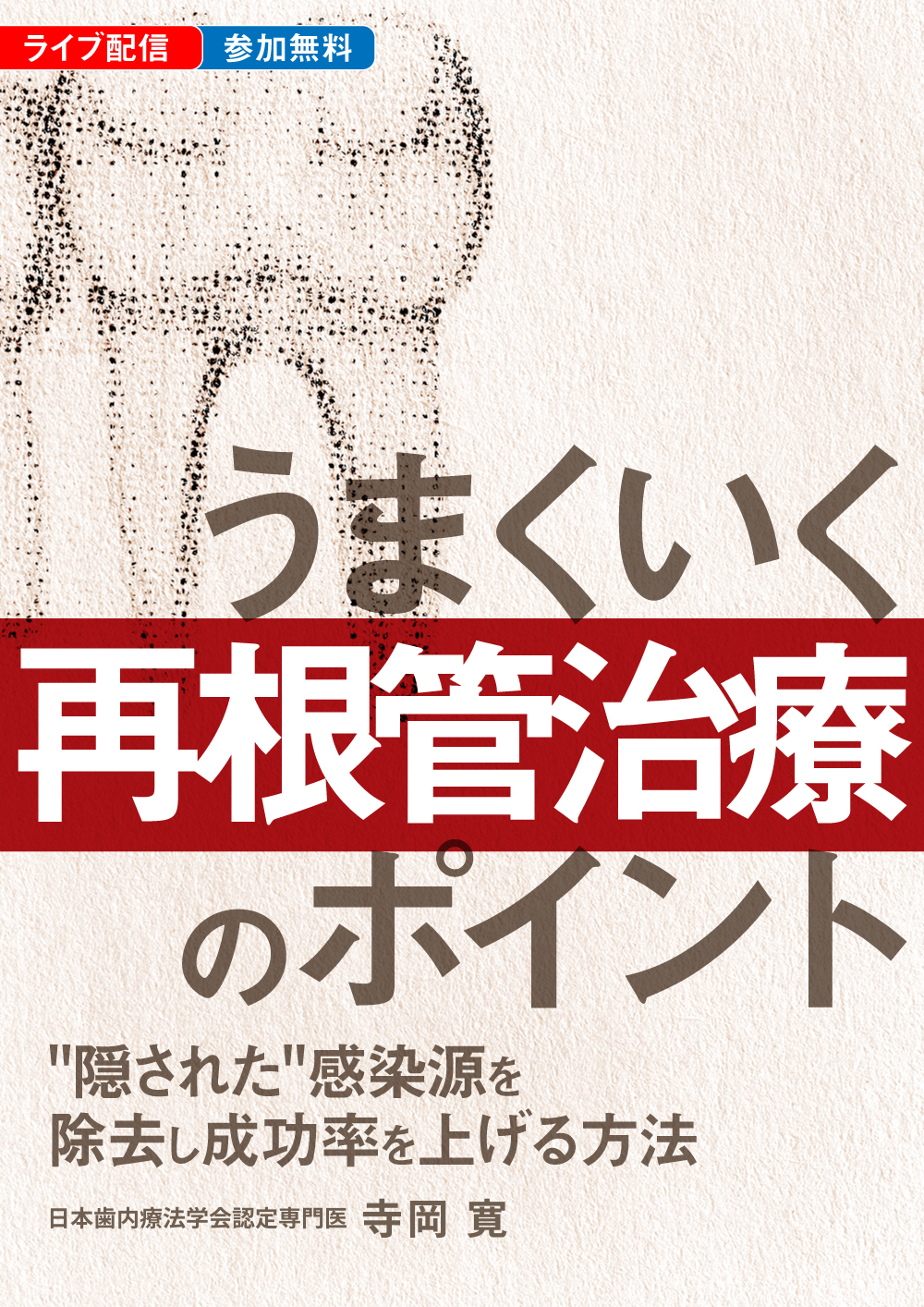 うまくいく再根管治療のポイント｜歯科オンラインセミナー・録画配信は